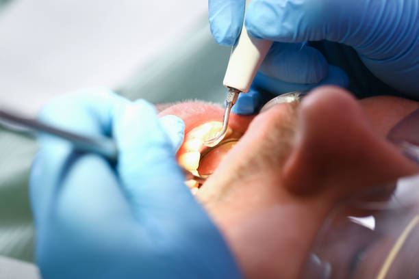 Best Pediatric Emergency Dentist in West Yarmouth, MA