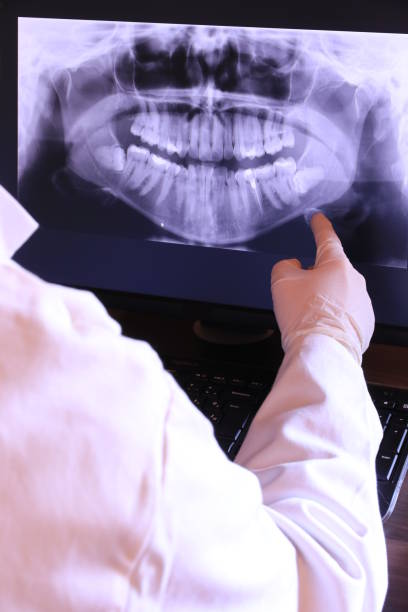Best Emergency Dentist for Lost Fillings or Crowns in West Yarmouth, MA